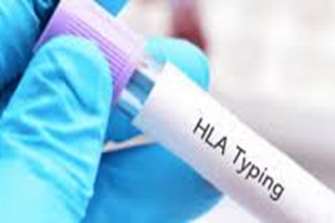 وبینار HLA Typing